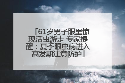 61岁男子眼里惊现活虫游走 专家提醒：夏季眼虫病进入高发期注意防护